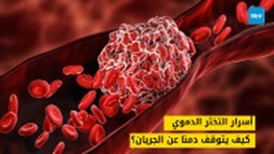 أسرار التخثر الدموي: كيف يتوقف دمنا عن الجريان