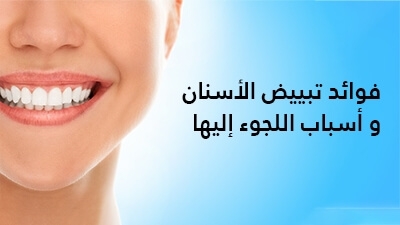 فوائد تبييض الأسنان و أسباب اللجوء إليها 