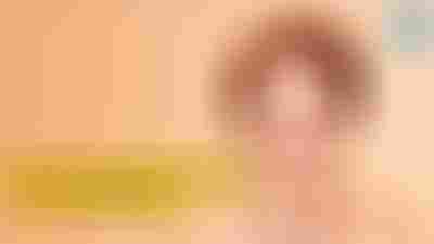 Tout ce que vous devez savoir sur les Skinboosters