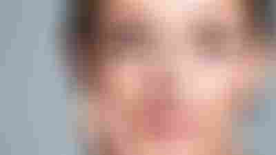 Le Comblement à l’Acide Hyaluronique – Une Solution pour Rajeunir et Harmoniser le Visage