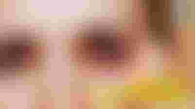 جفاف العين: أسبابه، أعراضه، وعلاجاته