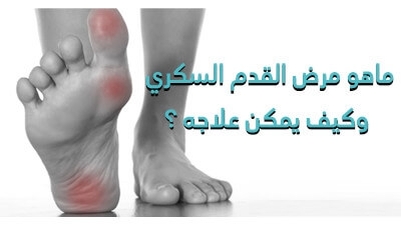 ماهو مرض القدم السّكّري pied diabétique وكيف يمكن علاجه ؟