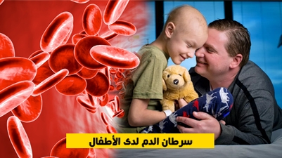 سرطان الدم لدى الأطفال