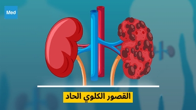 القصور الكلوي الحاد