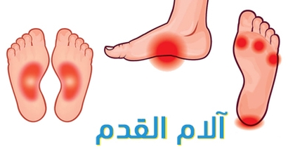 آلام القدم 
