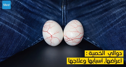 دوالي الخصية : أعراضها، أسبابها وعلاجها
