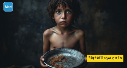 ما هو سوء التغذية؟