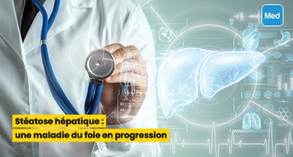 Stéatose hépatique : une maladie du foie en progression