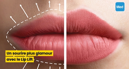 Un sourire plus glamour avec le Lip Lift