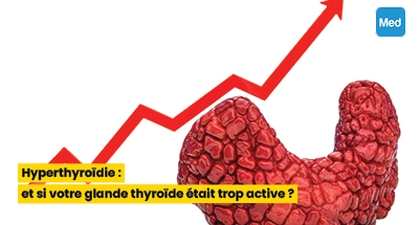 Hyperthyroïdie : et si votre glande thyroïde était trop active ?