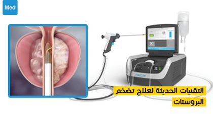 التقنيات الحديثة لعلاج تضخم البروستات
