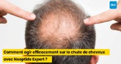 Comment agir efficacement sur la chute de cheveux avec Neoptide Expert ?