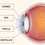 Dr N Aboubakra Epse Safi Ophthalmologist